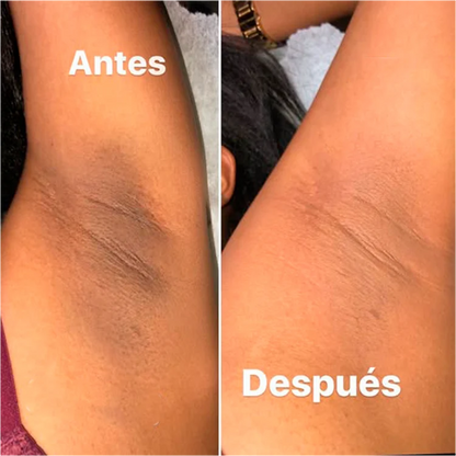 Ácido Glicólico 7%: Renueva tu piel y reduce la apariencia de manchas en 14 días